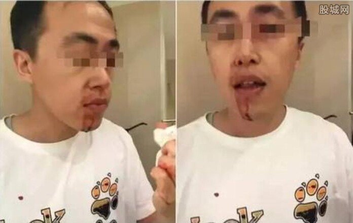 男女试衣间遭暴打