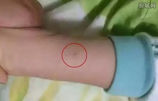 幼儿园全班遭针扎